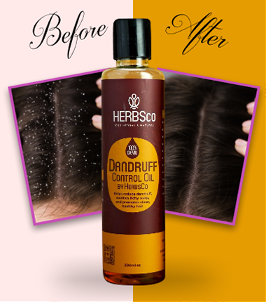 ANTI HAIR Dandruff by Herbsco