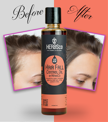 Anti Hair Fall by Herbsco
