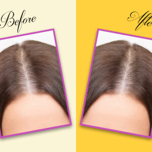 Hair Growth Buy Shampoo And Oil