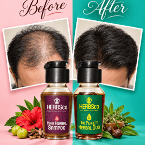 HairFall COntrol