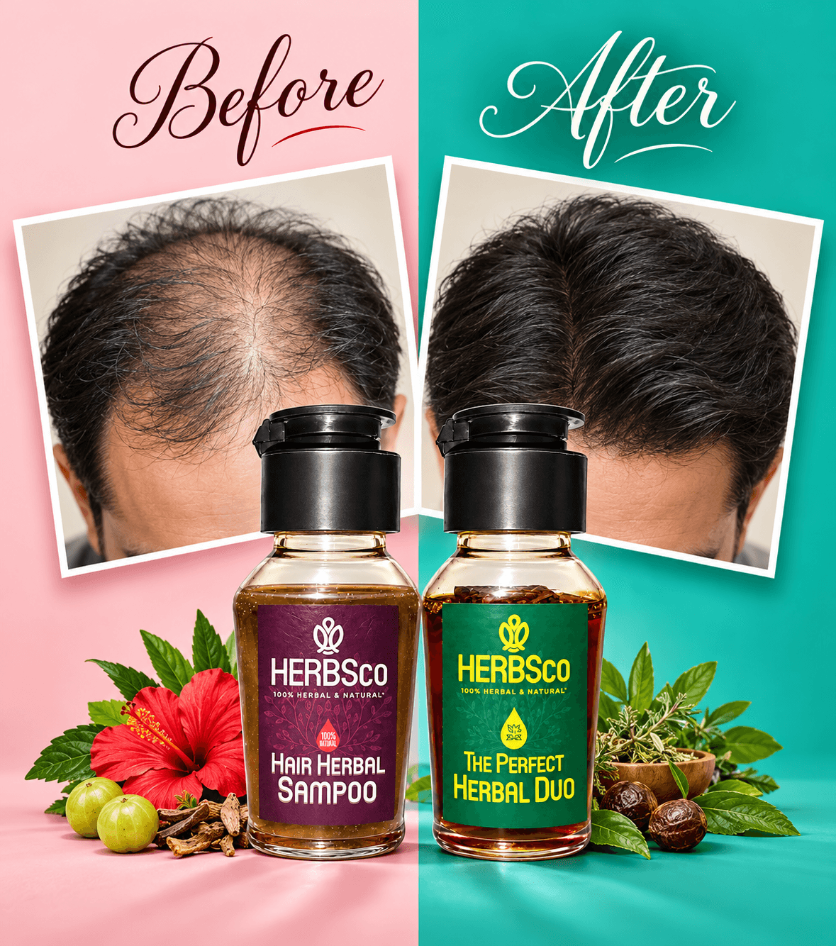 HairFall COntrol